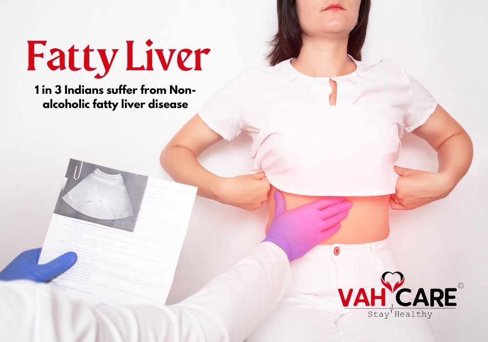 Unveiling the Silent Epidemic: Navigating Fatty Liver – Causes, Symptoms, and Solutions